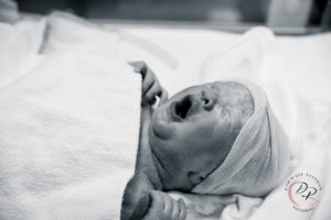 Geplande keizersnede newborn